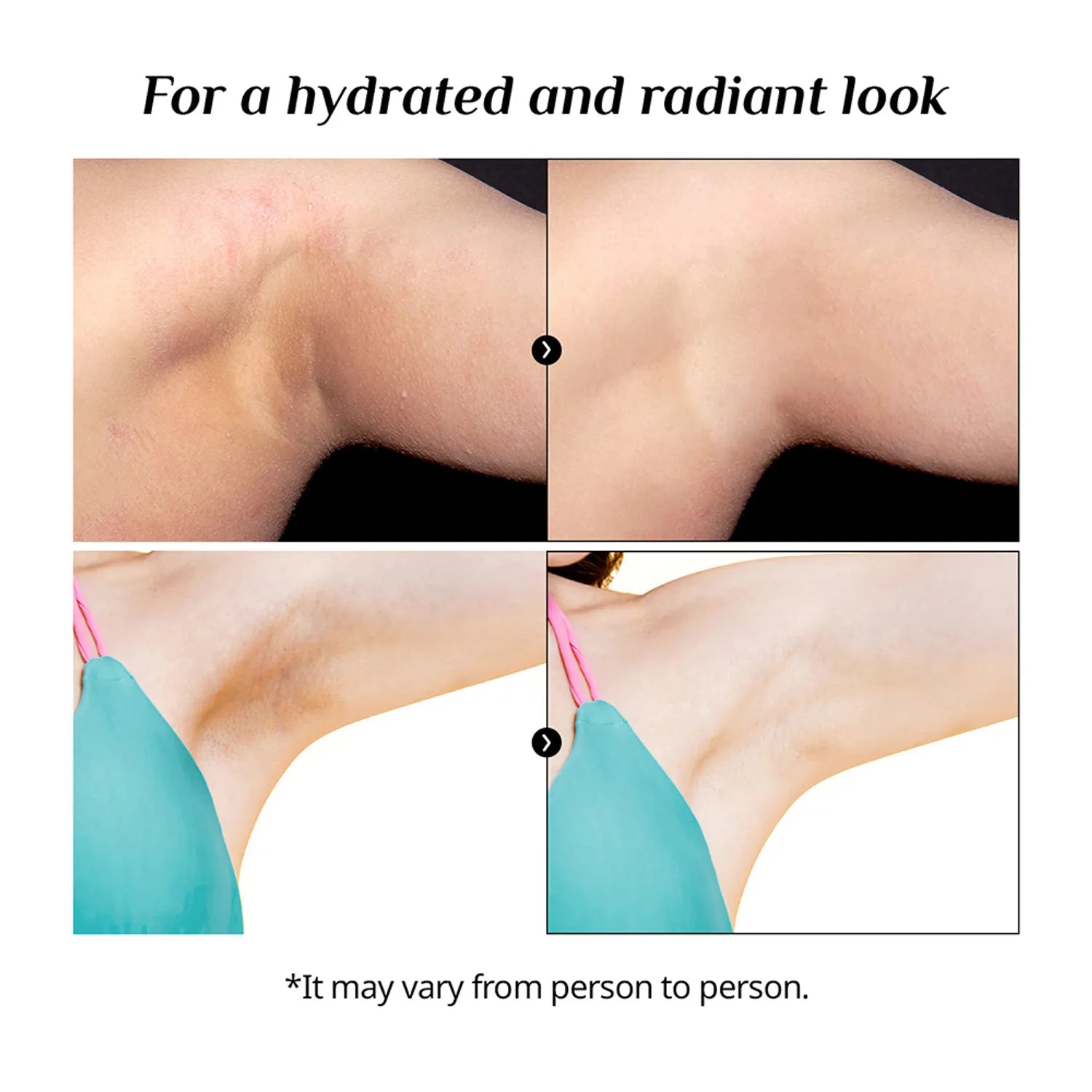 BnD Underarm & Armpit Cream 100ml